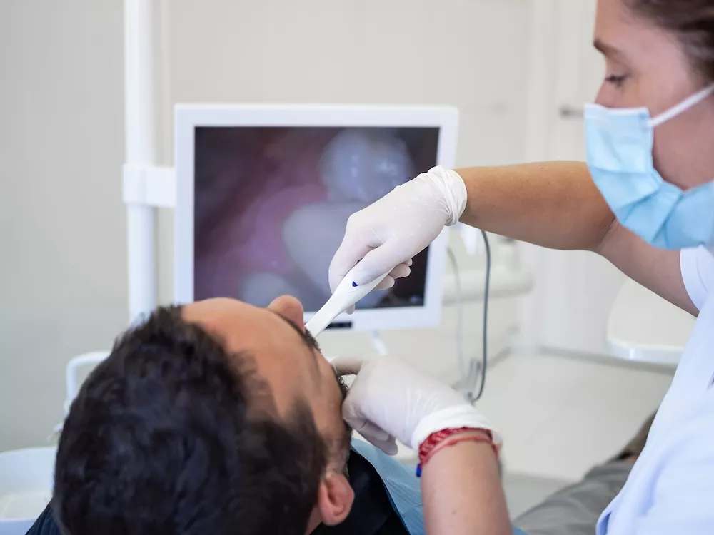 Intraoral-Kameras